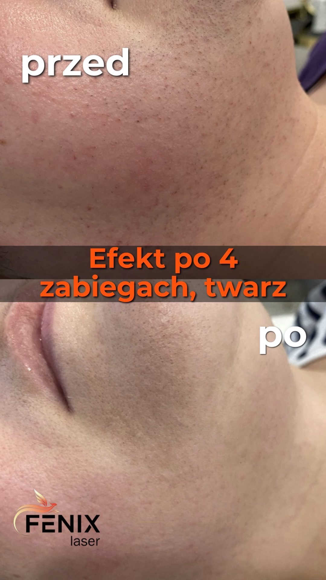 efekty8